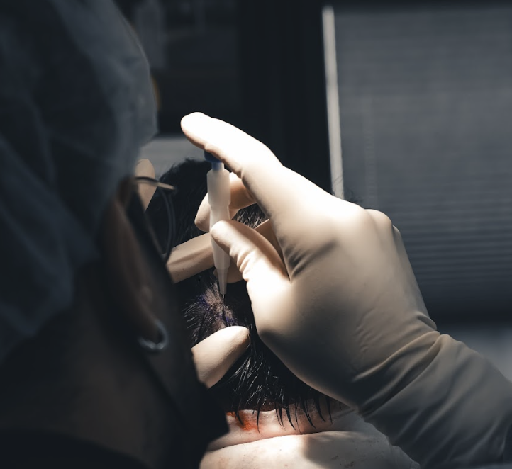 DHI vs. FUE – Welche Methode ist die richtige für dich?