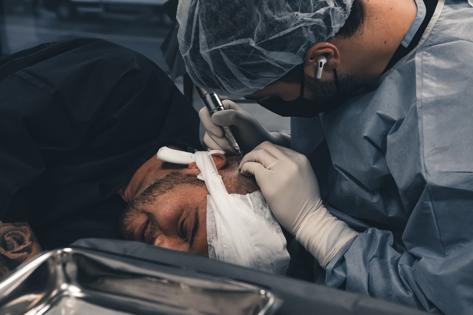 FUE-Haartransplantation in der Praxis