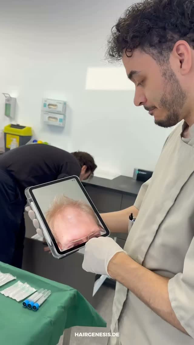 Der Wirbel — die unterschätzte Zone. | Hair Genesis Mannheim