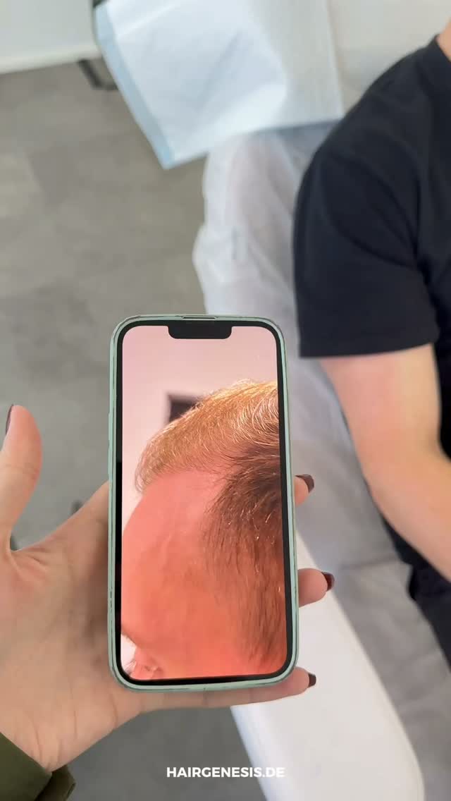 „Ein super Zwischenergebnis." Dr. | Hair Genesis Mannheim